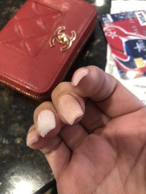 The other hand the nail doesn't even have shape