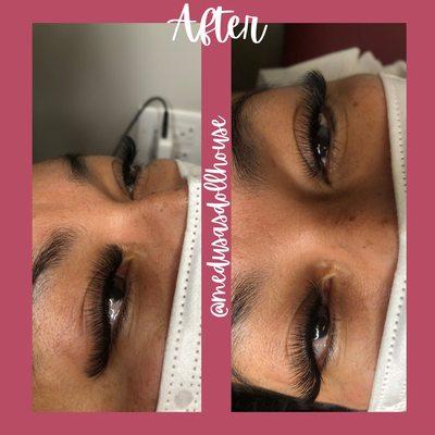 After a Refill using 6D volume eyelash extensions, to give a full voluminous gorgeous look.