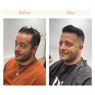 Before and after pictures from one of our clients!