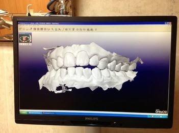 Advanced machinery and hi-tech cameras used instead of molds