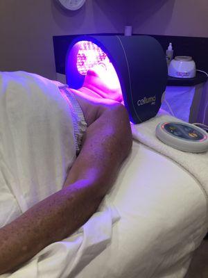 Celluma led therapy