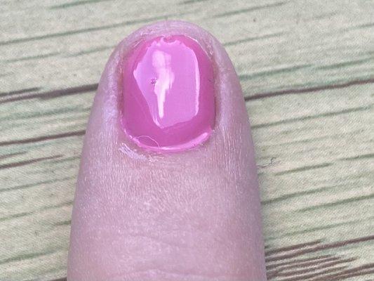 Fingernail with polish pooled in the cuticles.