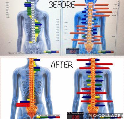 Pain and my body overcompensating. Stress score should be closer to 100's.