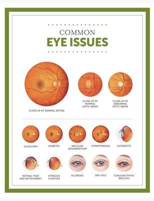 Common eye issues we treat here.