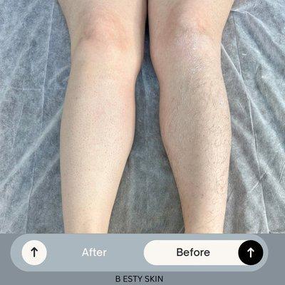 Leg wax before and after