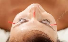 Face needling