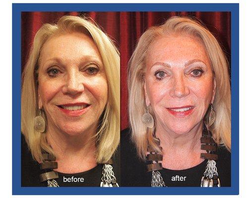 Blondes DO have more fun...with beautiful microblading!