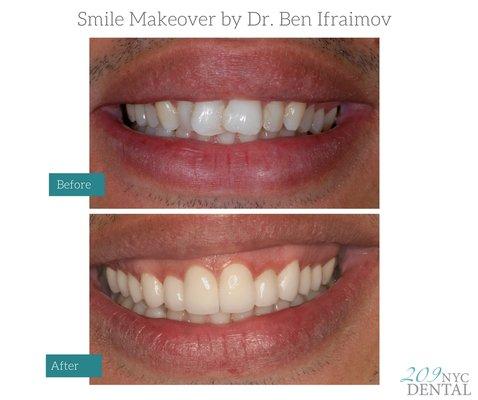 Cosmetic Dental Treatment by Dr. Ben Ifraimov