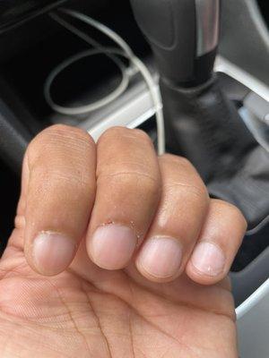 Cuticles (post service) with slightly injured finger from all the plucking