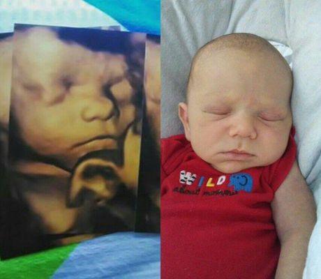 Before and after photo of baby's 4D ultrasound and after birth photo