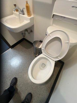 I've never seen my toilet this clean.