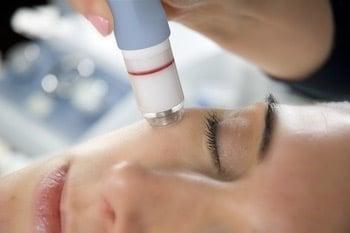 Wet Microdermabrasion treatment