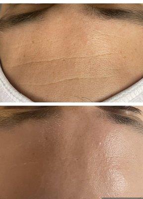 Mens facial