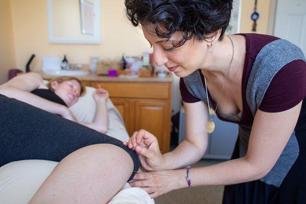 Prebirth acupuncture treatments help baby arrive around 40 weeks