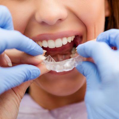 Invisalign clear aligners at Total Health Dental Care