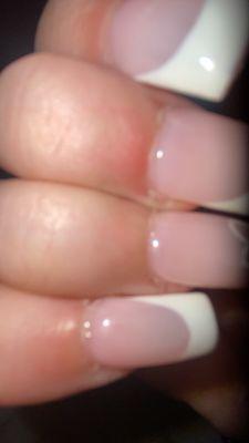 CUTICLE DAMAGING.