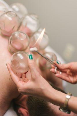 Tight muscles, high blood pressure, or just feeling sluggish?  Come in and discuss with Dr. Emy if cupping is right for you.