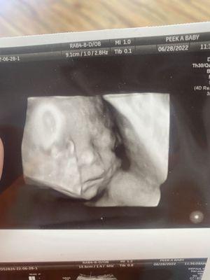 27 week ultrasound