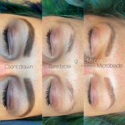 Restoring a sparse and patchy brow line