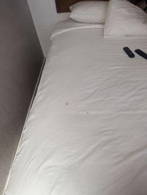 Stains on the sheets.