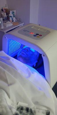 Blue Light therapy (For Acne)