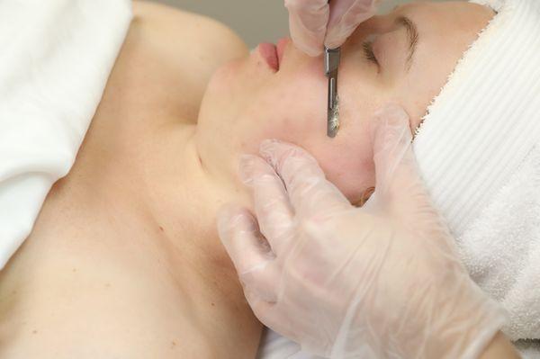 Dermaplaning facial