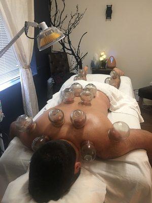 CUPPING