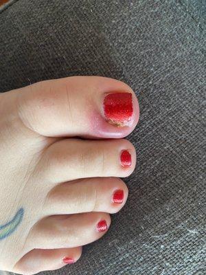 Day 3 after pedi