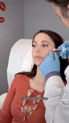 Full Facial Sculpting with Zero Bruising and Zero Downtime - Dr. Rob Berberian in Newport Beach