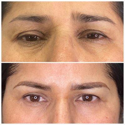 Microblading and shading combination