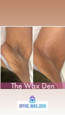 Before and after waxing done by The Wax Den