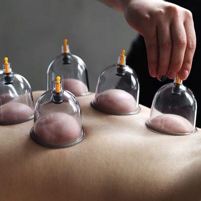 One of the oldest forms of therapy that have recently risen in popularity is cupping therapy.