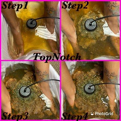 Ionic Foot Detox help to pull toxins from a large numbers of the body system