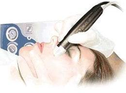 Microdermabrasion Facelogix