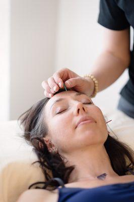 Acupuncture can help bring relief from chronic and acute pain as well as a host of other conditions.