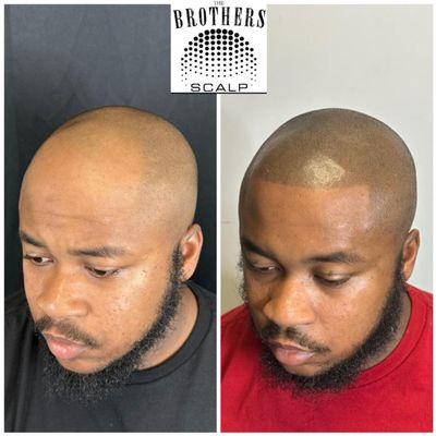 Brothers Scalp