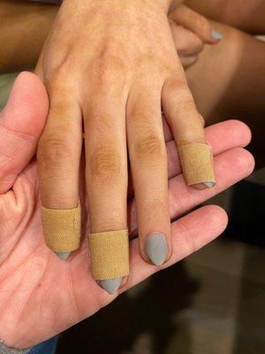 Fingers with cuts