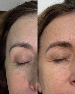 Before and after natural brow shaping