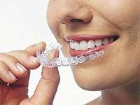 Invisalign