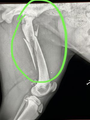 Spiral fracture back leg