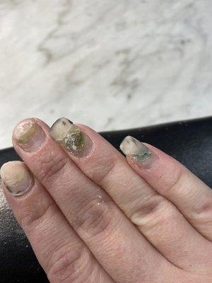 More mold under nails