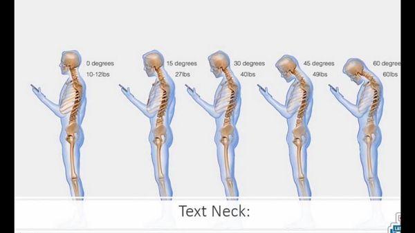 Are you developing text neck? We can help!