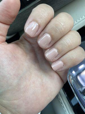 Overgrown cuticles botched shellac