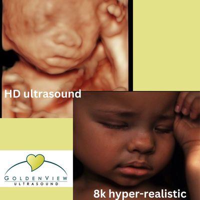 GoldenView Ultrasound