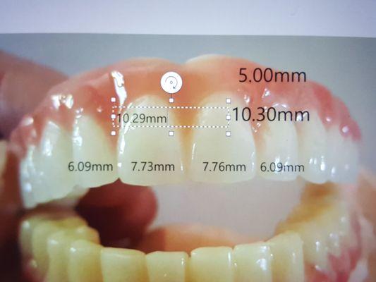 Soter's first temps, uppers tilted and lowers wrong color.