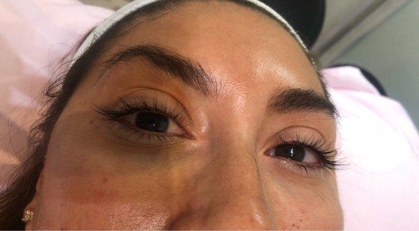 Eyelash Lift after