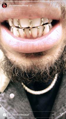 Chris Brown custom grill from STL GRILLZ