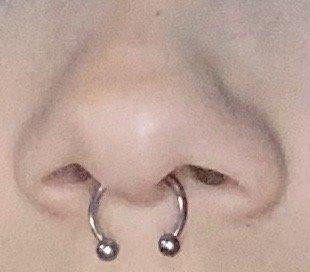 Low, crooked septum.