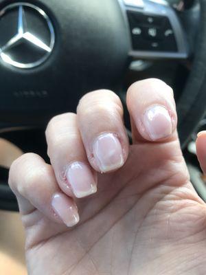 No cuticle removal