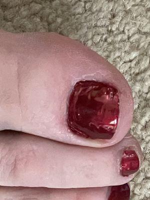 Bad painted nail